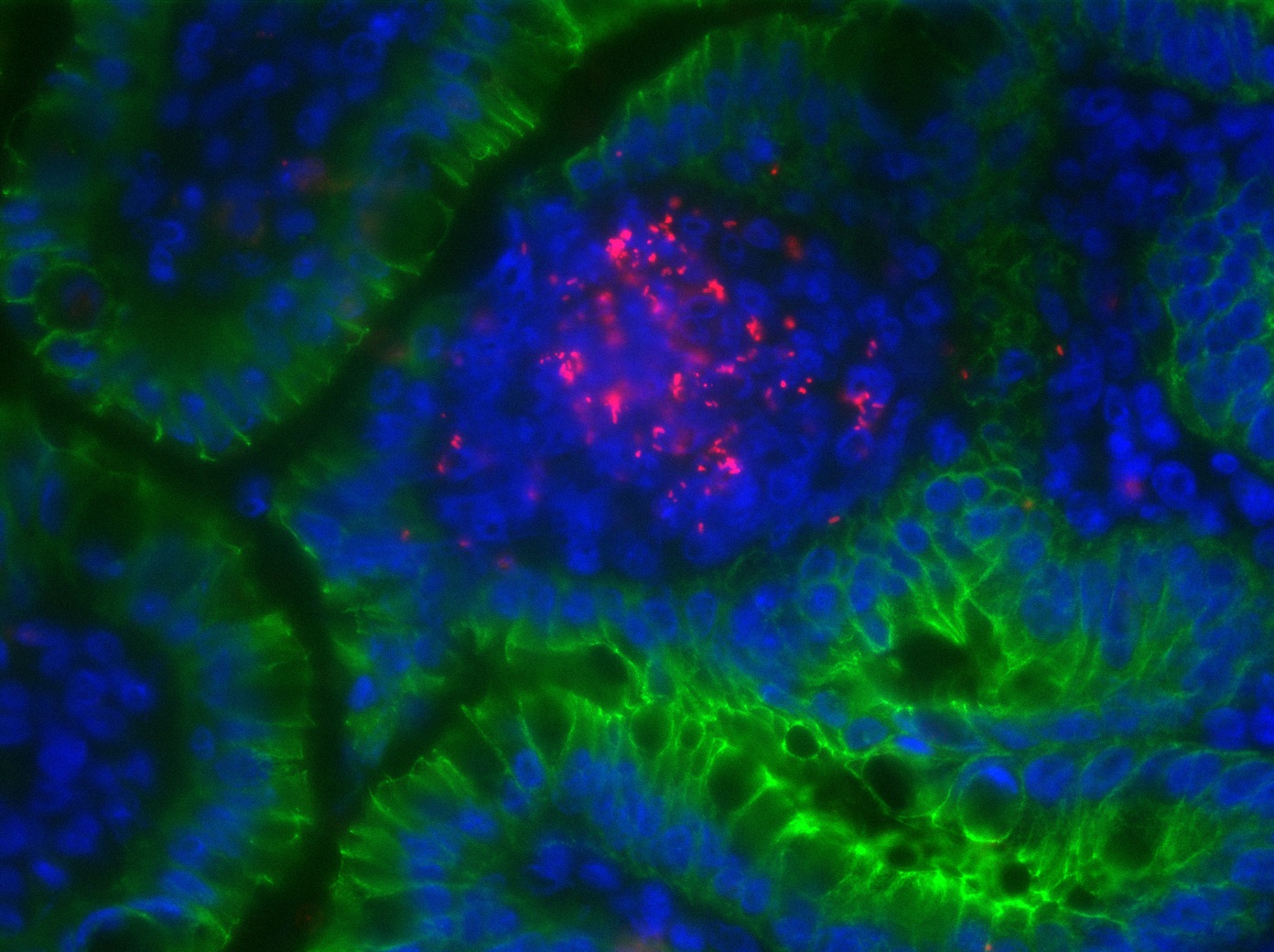 Listeria monocytogenes (rouge/red) - Institut Pasteur Listeria monocytogenes (rouge/red) - Institut Pasteur