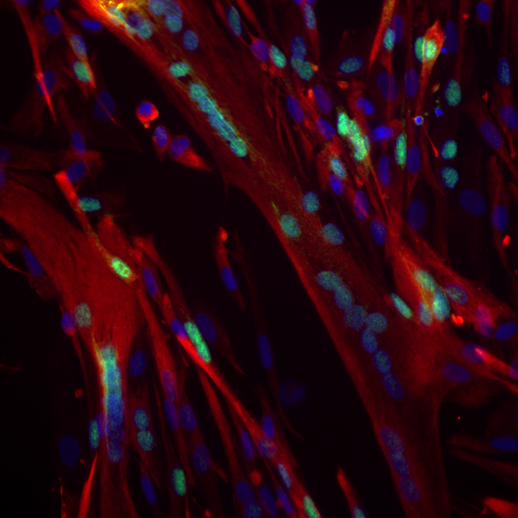 Myotube obtenu in vitro à partir de tissu musculaire humain - Institut Pasteur Myotube obtenu in vitro à partir de tissu musculaire humain - Institut Pasteur