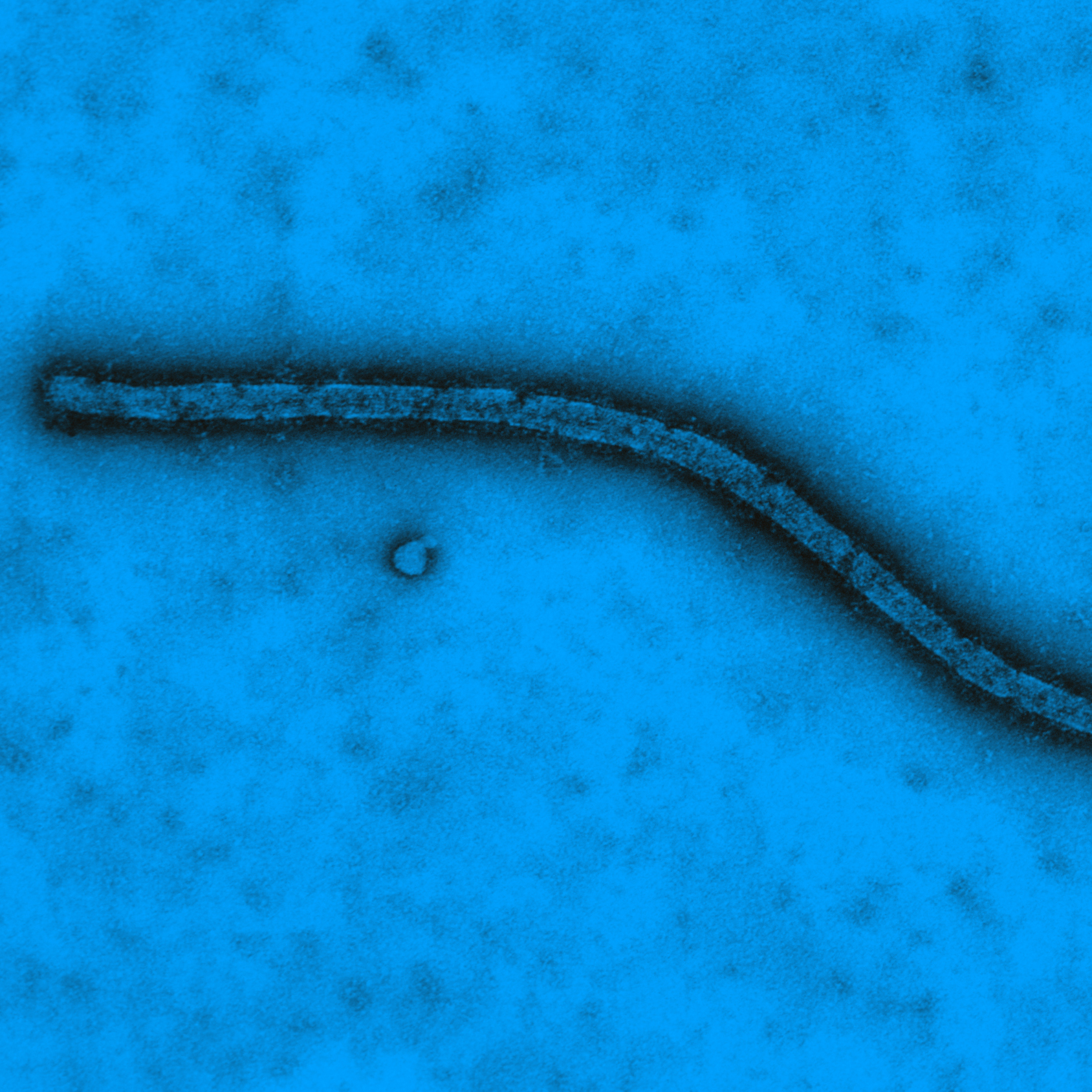 Virus Ebola vu en microscopie électronique à transmission - Institut Pasteur Virus Ebola vu en microscopie électronique à transmission - Institut Pasteur