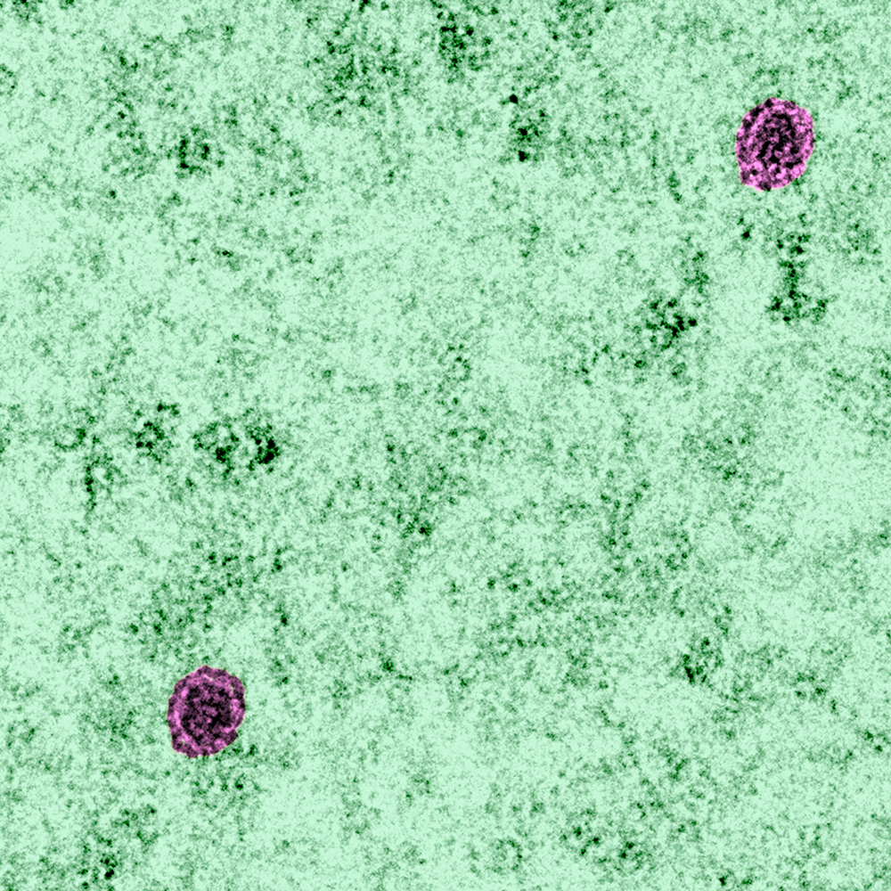 Cellules infectées par le virus du Zika en microscopie électronique à transmission - Institut Pasteur Cellules infectées par le virus du Zika en microscopie électronique à transmission - Institut Pasteur