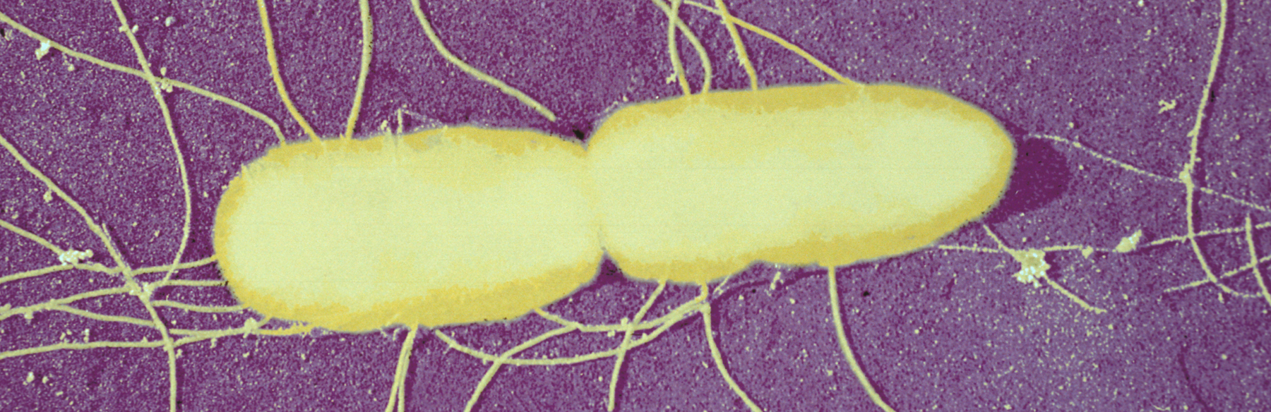 Santé Publique - CCOMS - Salmonella - Institut Pasteur Santé Publique - CCOMS - Salmonella - Institut Pasteur
