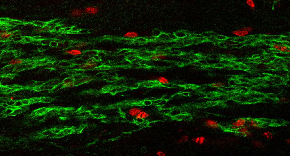 Migration néo-neurones adulte - Institut Pasteur Migration néo-neurones chez adulte - Institut Pasteur