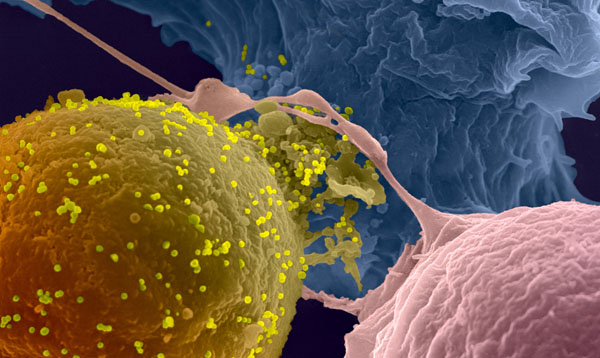 La recherche sur le VIH/sida - Institut Pasteur La recherche sur le VIH/sida - Institut Pasteur