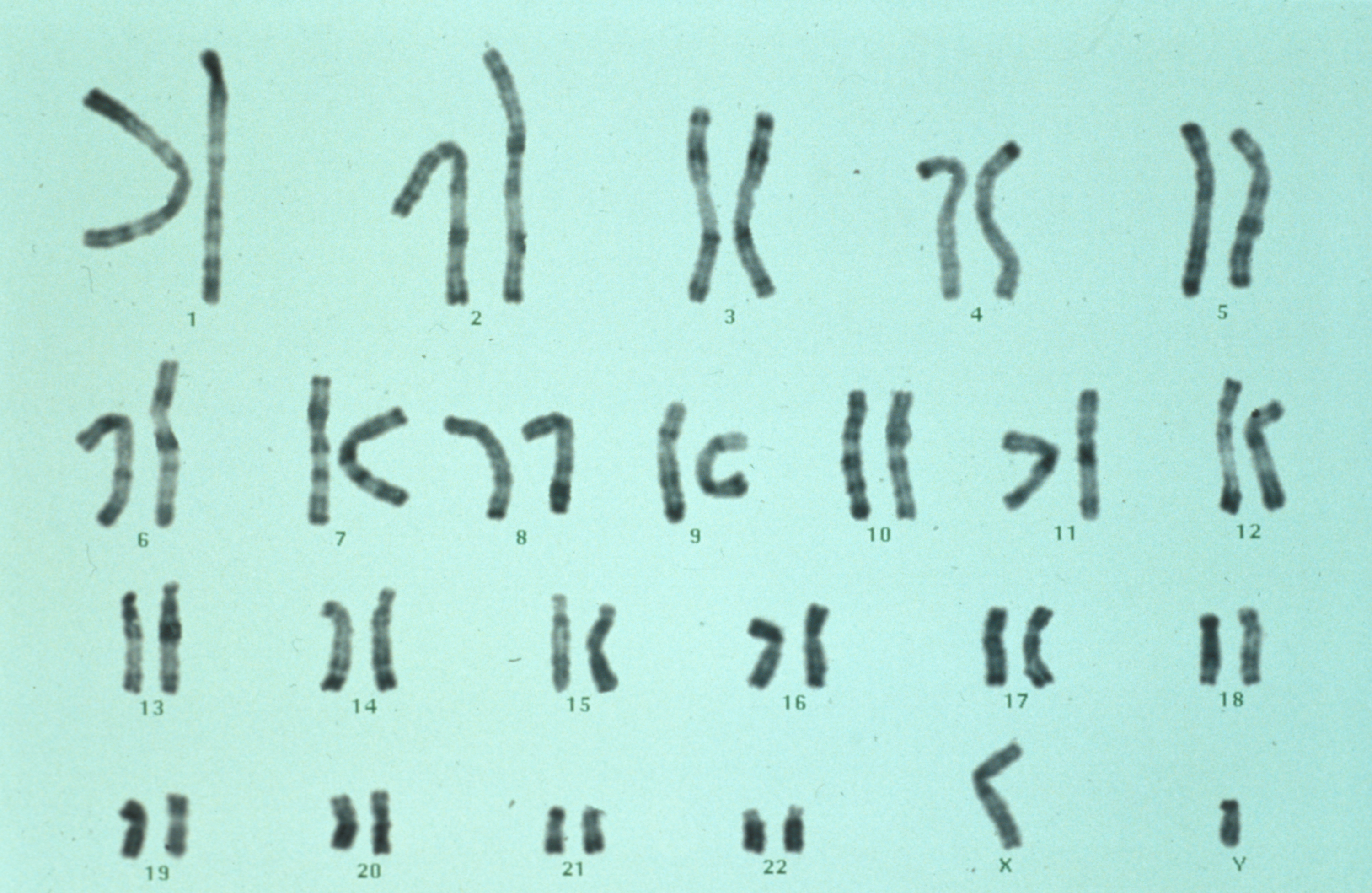 Caryotype chromosome - Institut Pasteur Caryotype chromosome - Institut Pasteur