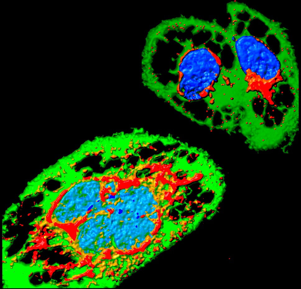 Zika infection - Institut Pasteur Zika infection - Institut Pasteur