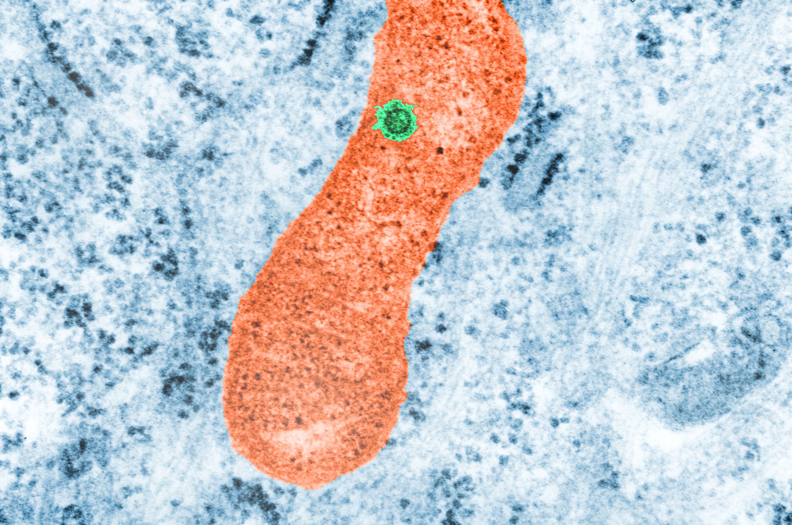 virus dengue virus dengue