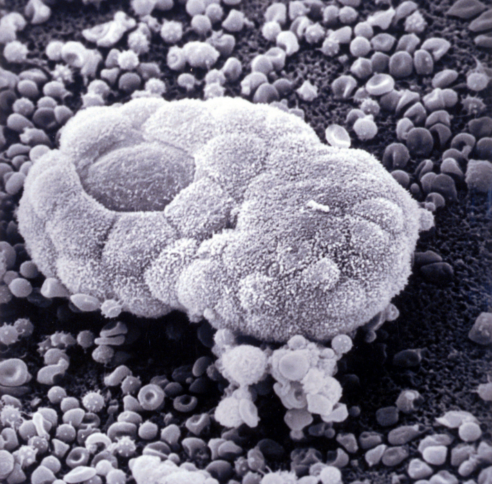 teratocarcinome - Institut Pasteur teratocarcinome - Institut Pasteur