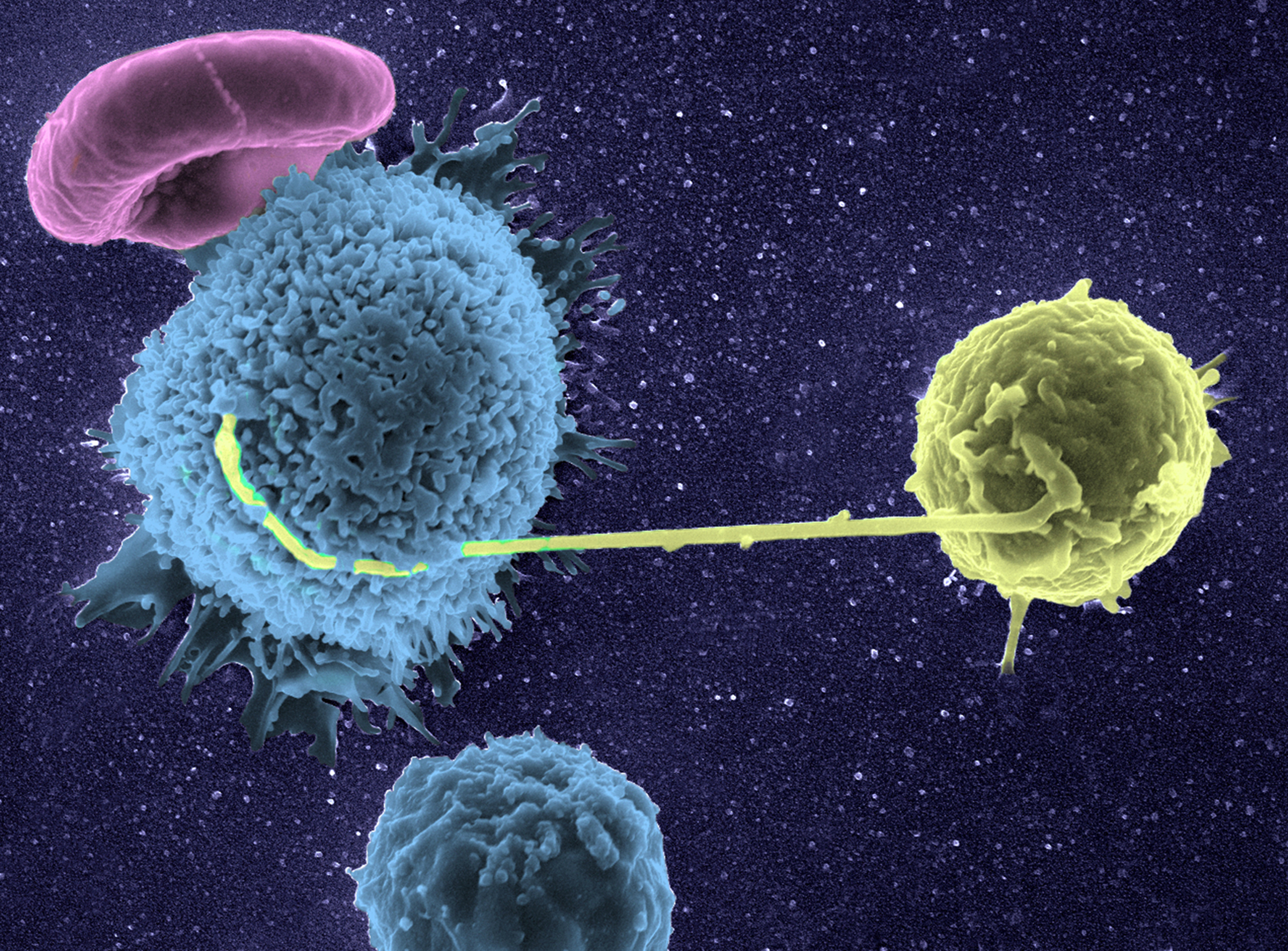 lymphocyte - VIH - Institut Pasteur lymphocyte - VIH - Institut Pasteur