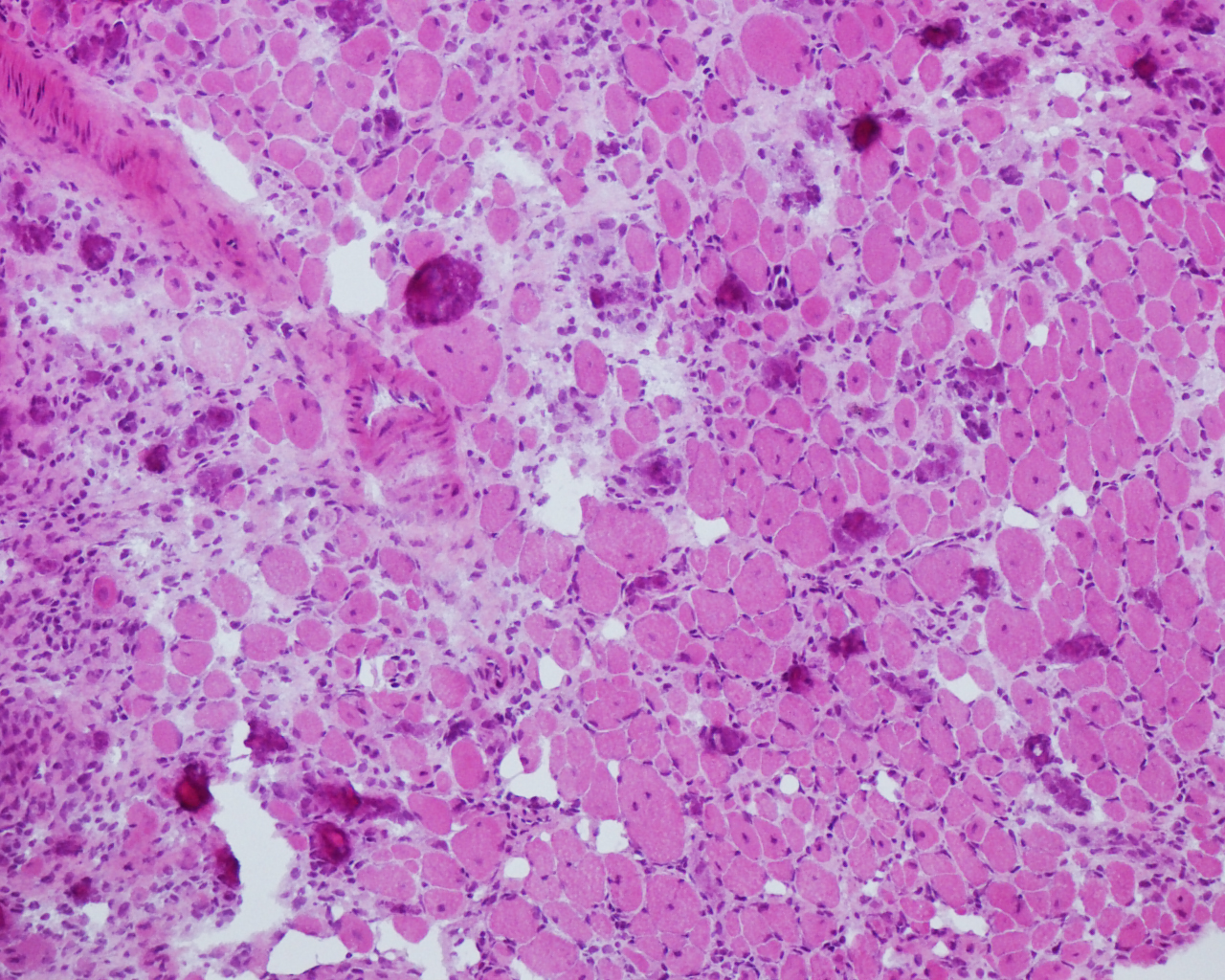 sepsis - Institut Pasteur sepsis - Institut Pasteur