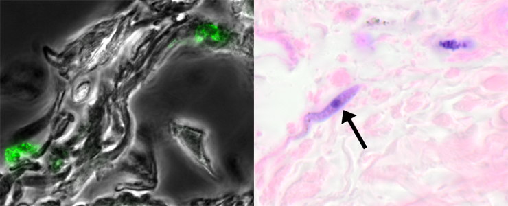 Maladie du sommeil : le parasite se cache dans la peau - Institut Pasteur Maladie du sommeil : le parasite se cache dans la peau - Institut Pasteur