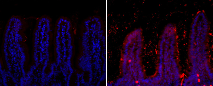 Trop de gras déséquilibre rapidement la flore intestinale - Institut Pasteur Trop de gras déséquilibre rapidement la flore intestinale - Institut Pasteur