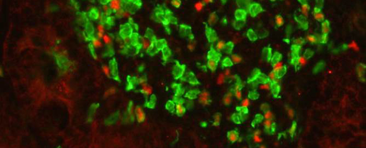 Comment le microbiote bloque les allergies Comment le microbiote bloque les allergies