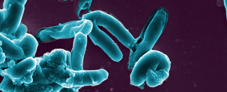 Tuberculose : un candidat vaccin prometteur - Institut Pasteur Tuberculose : un candidat vaccin prometteur - Institut Pasteur