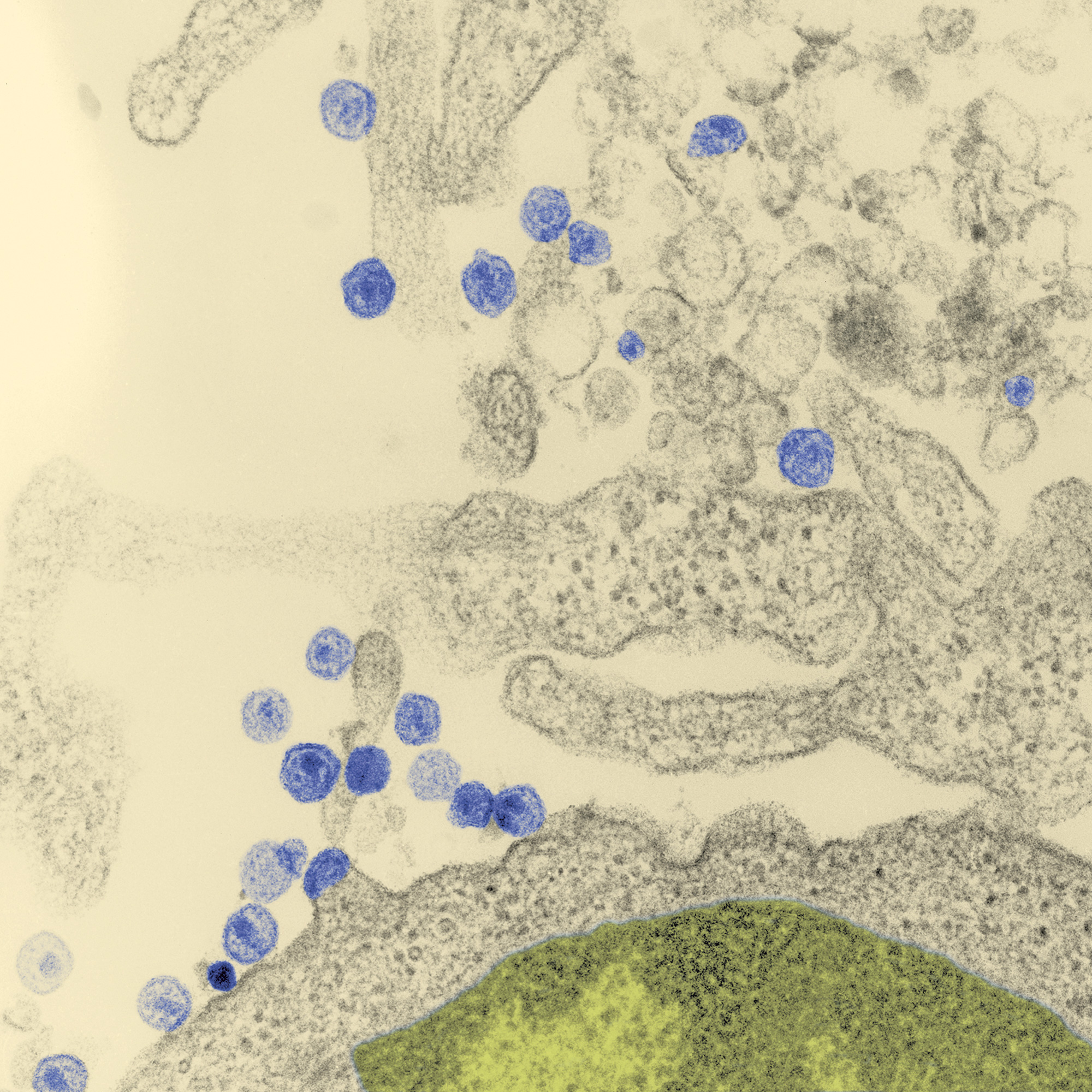 Lymphocyte T infecté par le Virus LAV (futur VIH) - Institut Pasteur Lymphocyte T infecté par le Virus LAV (futur VIH) - Institut Pasteur