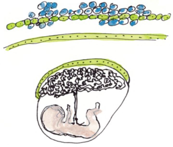 Grossesse pathologique : l’effet de l’interféron Grossesse pathologique : l’effet de l’interféron