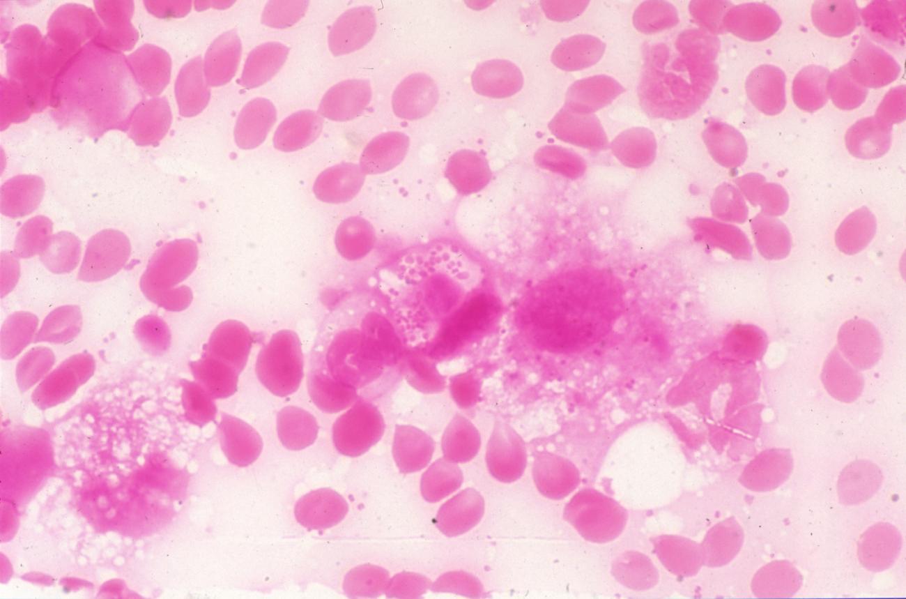 Neisseria meningitidis - Institut Pasteur Neisseria meningitidis - Institut Pasteur