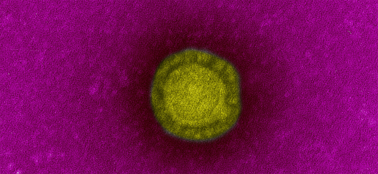 Fiche Maladie - Coronavirus de Wuhan - Institut Pasteur Fiche Maladie - Coronavirus de Wuhan - Institut Pasteur