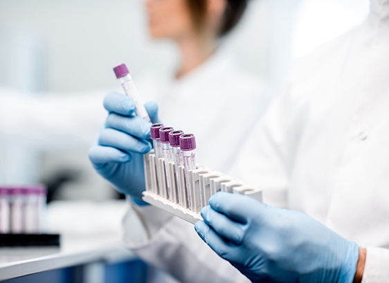 Task force SARS-CoV-2 - Institut Pasteur Task force SARS-CoV-2 - Institut Pasteur