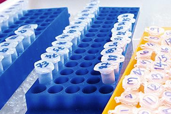LICENSING OPPORTUNITIES - Innovation - Institut Pasteur LICENSING OPPORTUNITIES - Innovation - Institut Pasteur