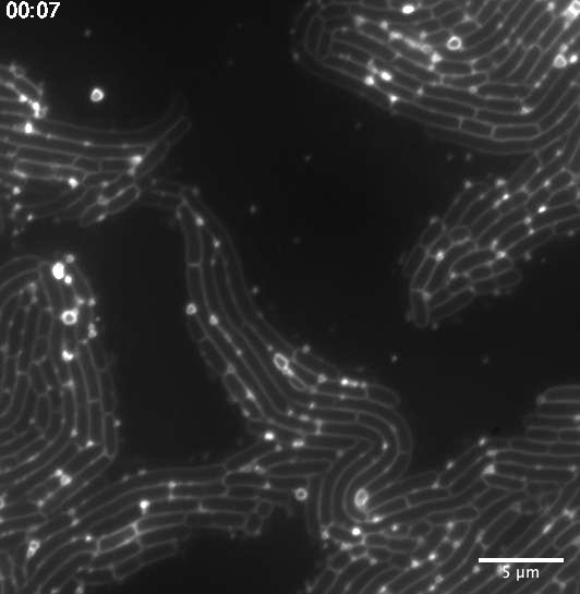 membrane vesicles