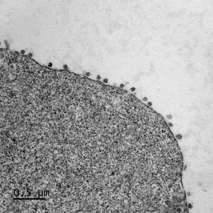Image de microscopie électronique montrant l’accumulation de particules virales à la surface de cellules dérivées d’un cerveau de chauve-souris Image de microscopie électronique montrant l’accumulation de particules virales à la surface de cellules dérivées d’un cerveau de chauve-souris
