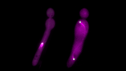 Structures aberrantes et contrastées du fuseau mitotique après surexpression (à gauche) et déplétion (à droite) de Csa6 dans des cellules de Candida albicans avec bourgeon allongé. Structures aberrantes et contrastées du fuseau mitotique après surexpression (à gauche) et déplétion (à droite) de Csa6 dans des cellules de Candida albicans avec bourgeon allongé.