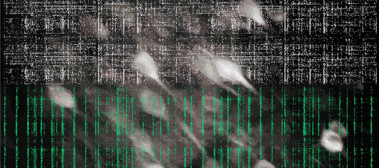 Activité d’un ensemble de neurones du cortex auditif pendant l’état d’éveil et sous anesthésie Activité d’un ensemble de neurones du cortex auditif pendant l’état d’éveil et sous anesthésie
