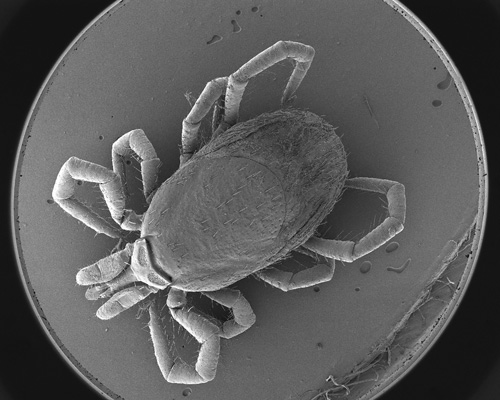 © Institut Pasteur, Thierry Blisnick Photographie de Tique au microscope à balayage éléctronique