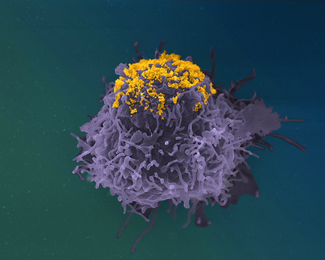 Accumulation de particules de VIH à la surface d’une cellule infectée - Institut Pasteur Accumulation de particules de VIH à la surface d’une cellule infectée - Institut Pasteur