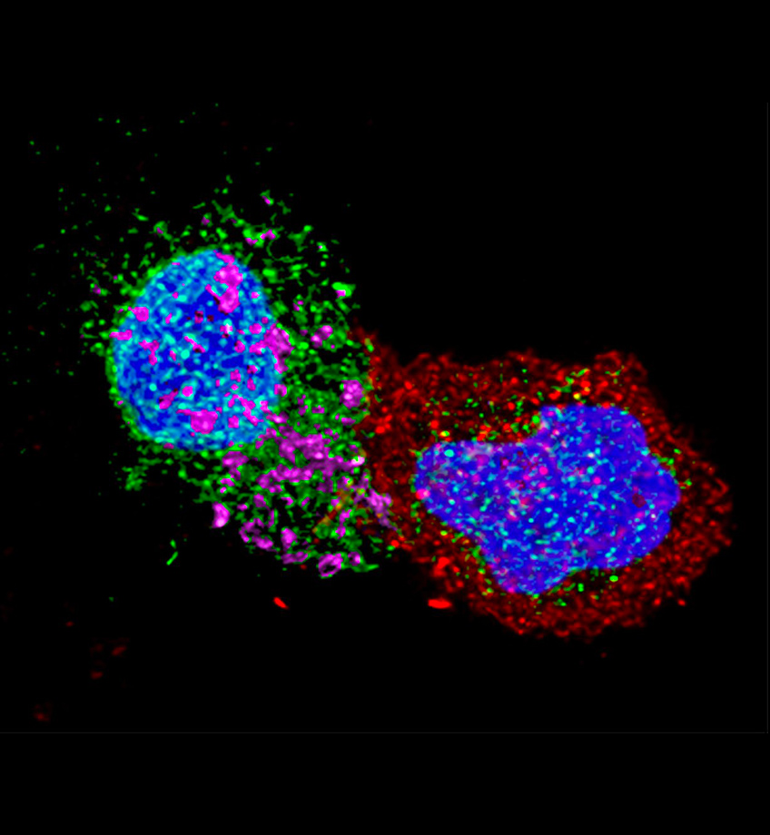 Cellules CD8 de patients contrôleurs en contact avec des cellules CD4 infectées par le VIH&nbsp;