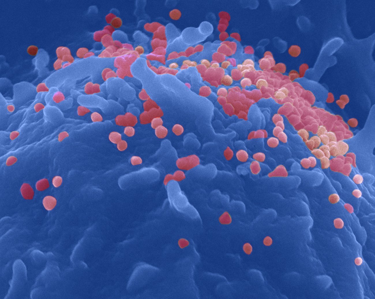 Particules du virus du Sida à la surface d'un lymphocyte T CD4 Particules du virus du Sida à la surface d'un lymphocyte T CD4