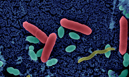 Projet SARA : surveillance de l’antibiorésistance en Afrique - Institut Pasteur