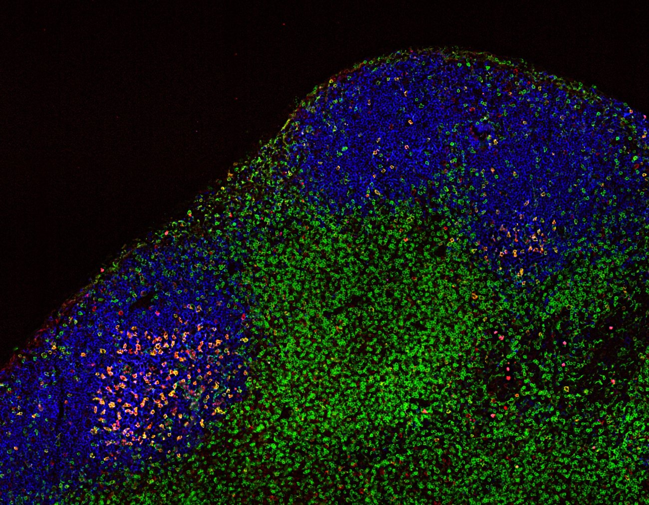 Anticorps anti-PD-1 - cellules T - ganglions lymphatiques - Institut Pasteur Anticorps anti-PD-1 - cellules T - ganglions lymphatiques - Institut Pasteur