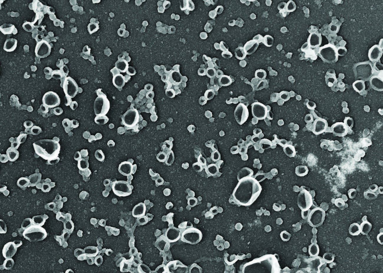 sacs poubelles cellulaires © Thomas Wollert sacs poubelles cellulaires © Thomas Wollert
