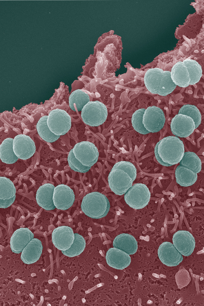 cours épidémiologie vaccinale