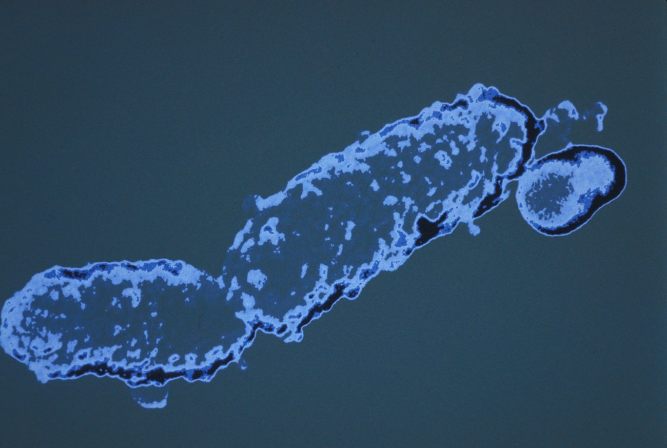 Bordetella pertussis