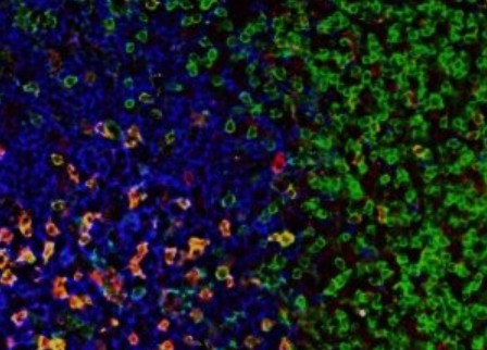 Immunofluorescence de sections de ganglions lymphatiques montrant l'expression de PD-1 (rouge), CD4 (vert), CD19 (bleu). Les cellules T auxiliaires folliculaires sont les principales cellules ciblées par l'anticorps anti-PD-1, dans les ganglions lymphatiq