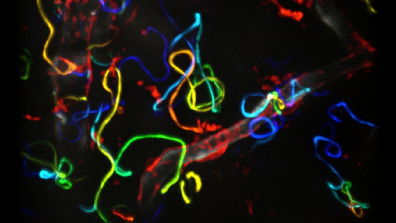 Migration des sporozoïtes de Plasmodium dans la peau. Migration des sporozoïtes de Plasmodium dans la peau.