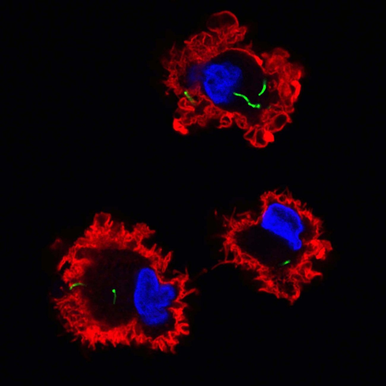 Le bacille de la tuberculose (en vert) entre dans les cellules dendritiques (en rouge) Le bacille de la tuberculose (en vert) entre dans les cellules dendritiques (en rouge). La microscopie confocale, ici utilisée, a eu un impact important pour certaines découvertes récentes concernant cette maladie.