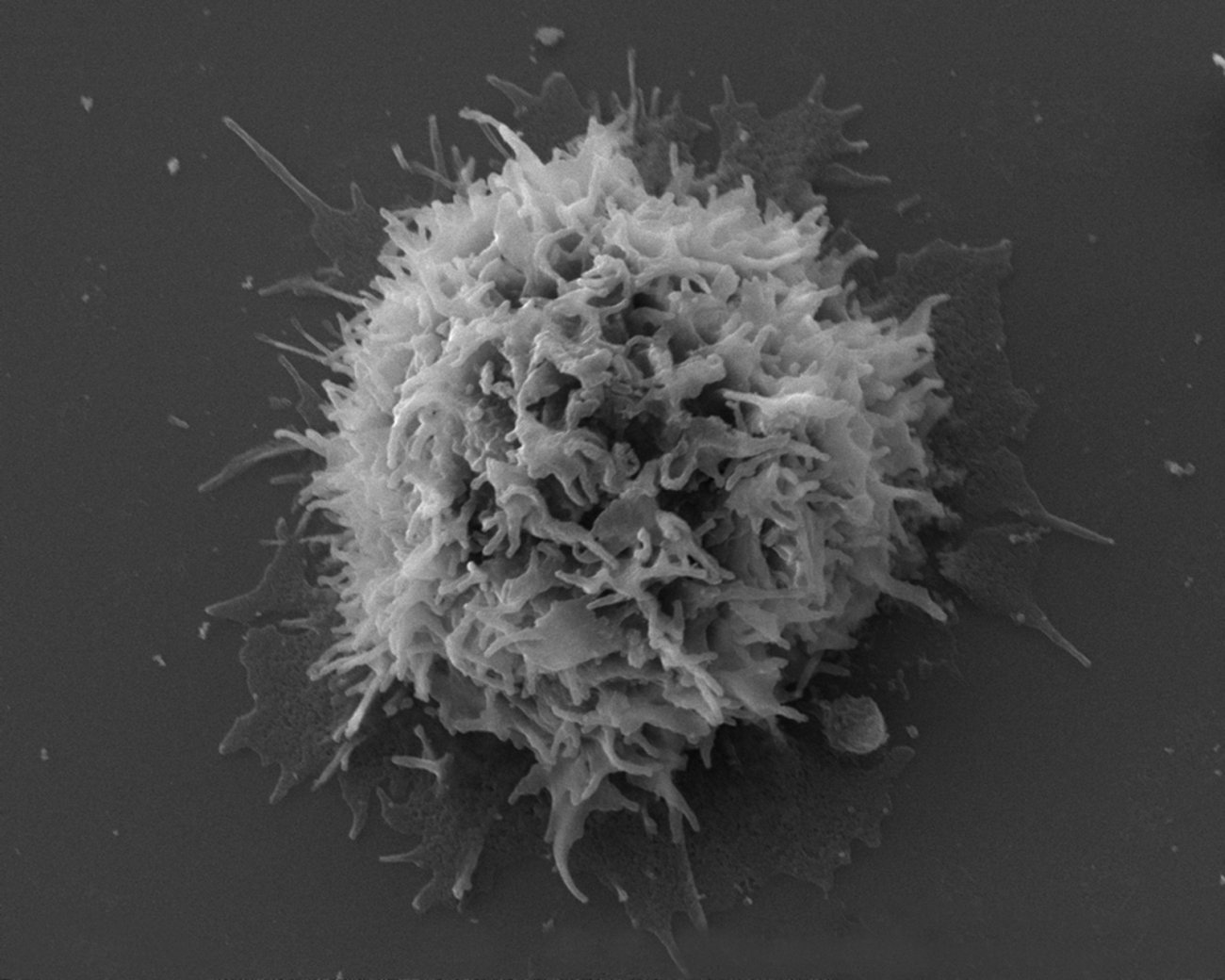 Lymphocyte T CD4 vu en microscopie à balayage. Lymphocyte T CD4 vu en microscopie à balayage.