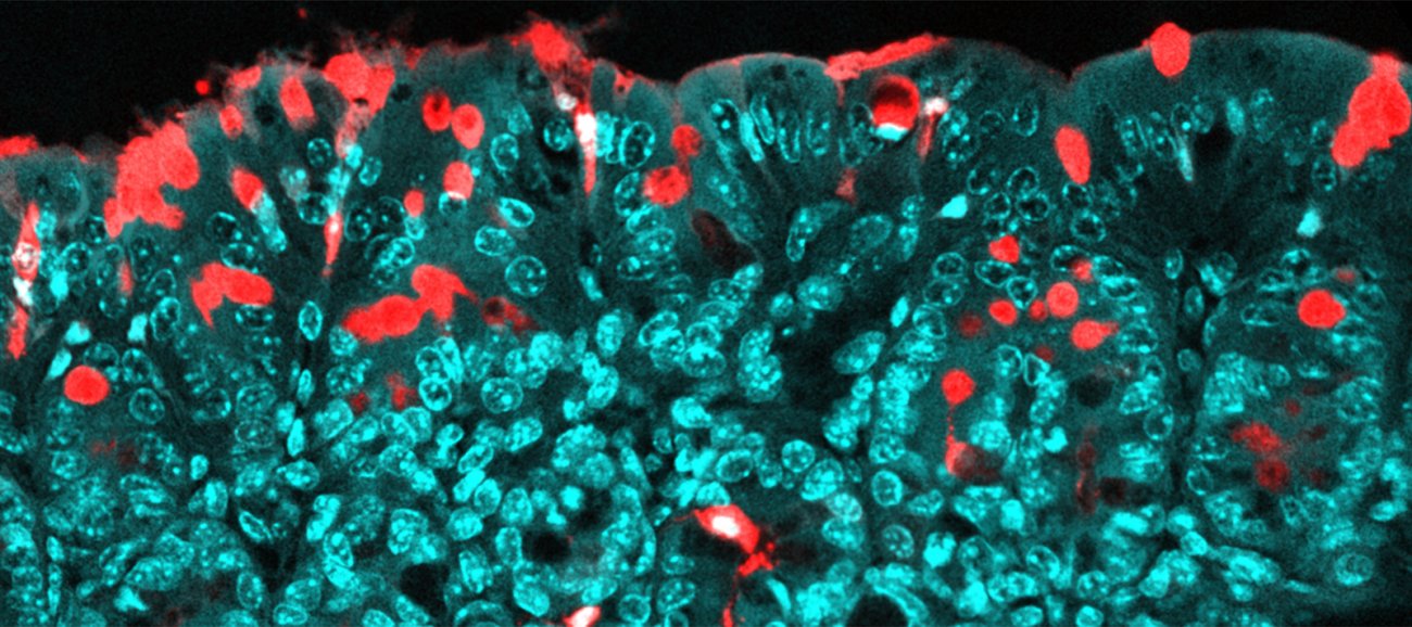Passage de molécules au travers de l’épithélium du colon, via des voies spécialisées (les cellules de goblet). En rouge : les molécules transportées (antigènes) ; en bleu : l’épithélium. Passage de molécules au travers de l’épithélium du colon, via des voies spécialisées (les cellules de goblet). En rouge : les molécules transportées (antigènes) ; en bleu : l’épithélium.