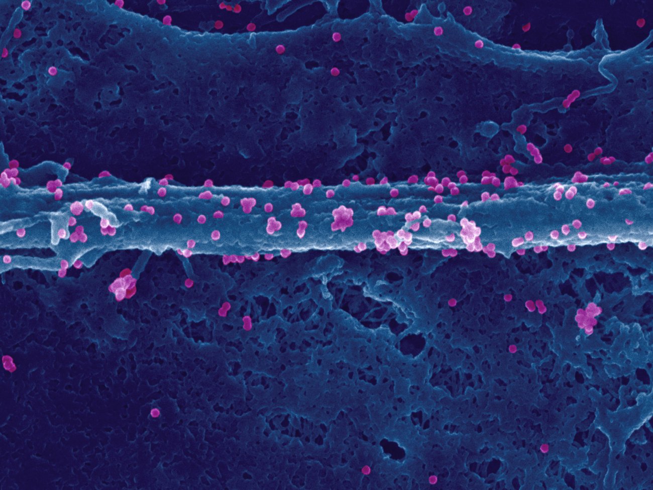 Virus chikungunya à la surface d'une cellule infectée Virus chikungunya à la surface d'une cellule infectée