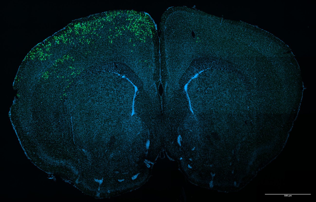 Microglies dérivées d'iPSC humaines xénogreffées dans un cerveau de souris