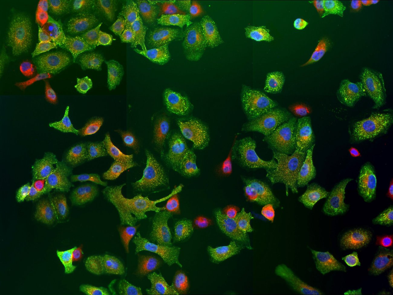 Détection par immunofluorescence de nucléoprotéines du virus de la grippe dans les cellules infectées.