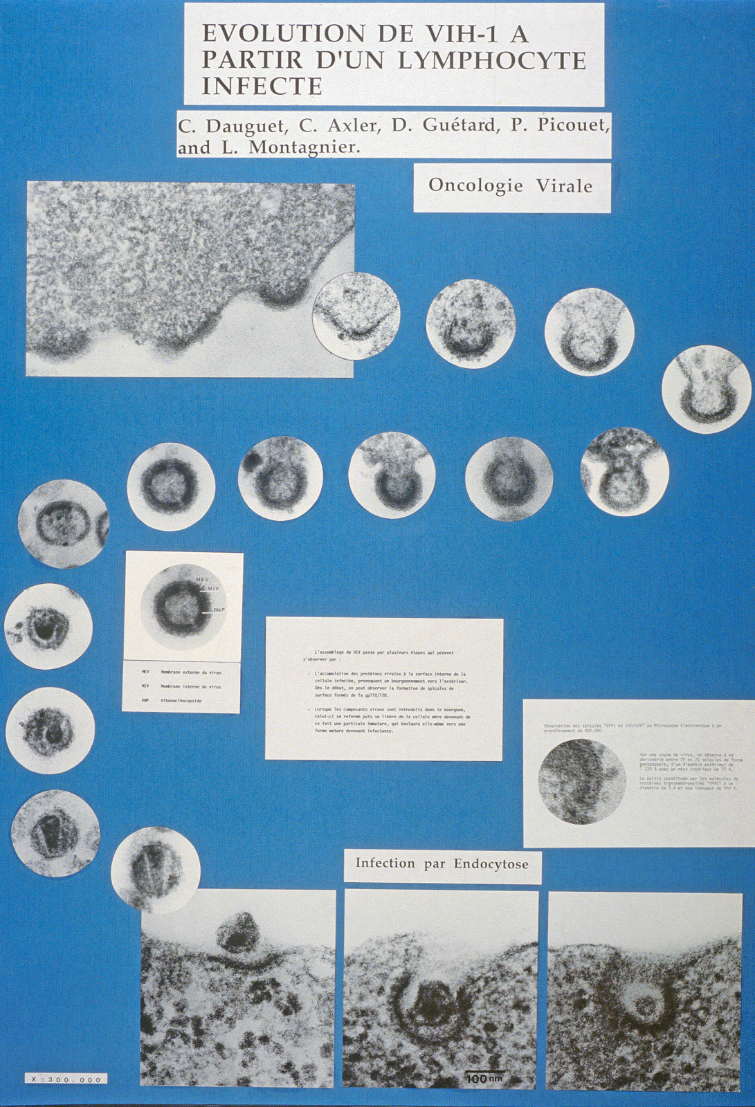 Couverture du cahier de laboratoire de Françoise Barré-Sinoussi en 1983, premières expériences montrant une activité reverse-transcriptase (spécifique des rétrovirus) dans les surnageants de culture de cellules d'un patient .