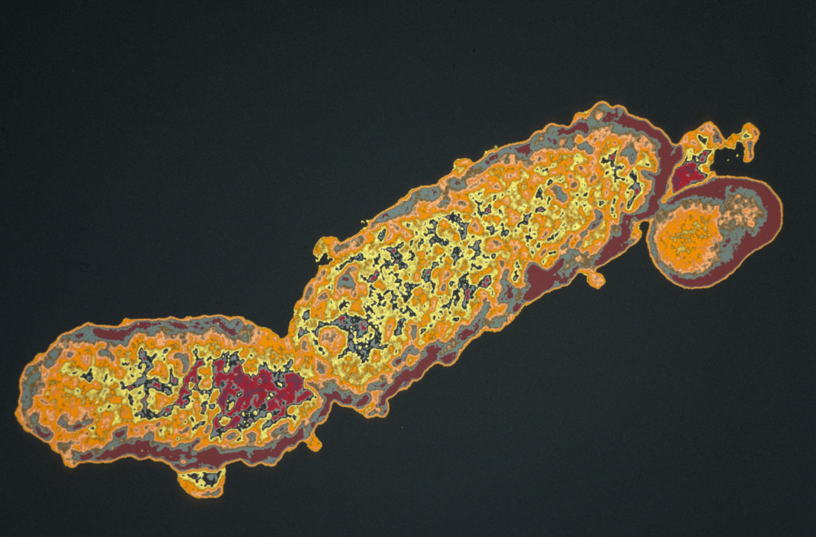 Bordetella pertussis