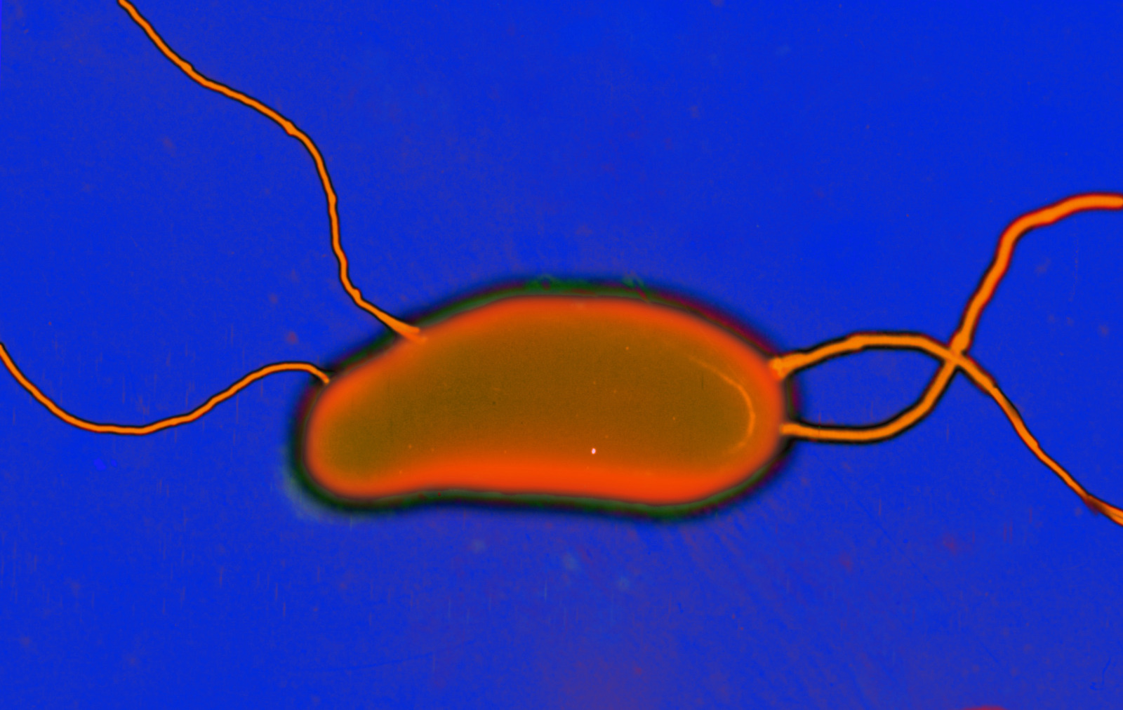 Vibrio cholerae - bactérie responsable du Choléra