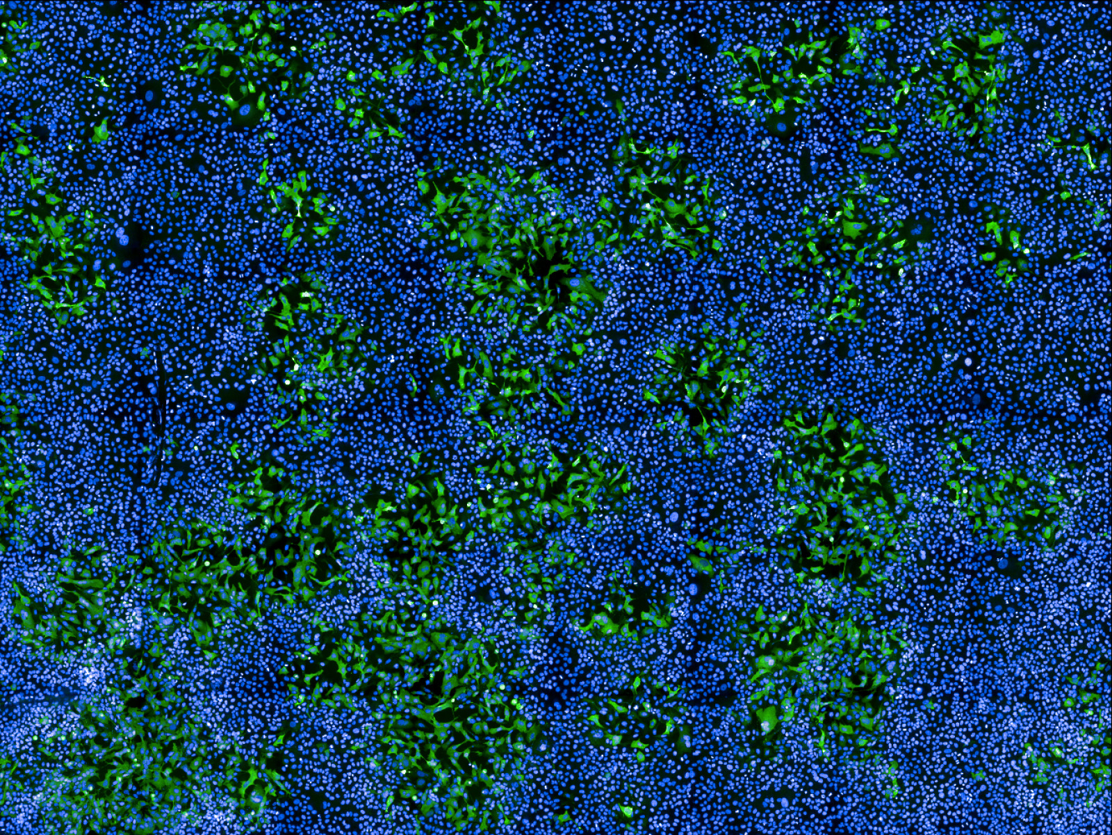 Cellules humaines infectées par MPXV (en vert)