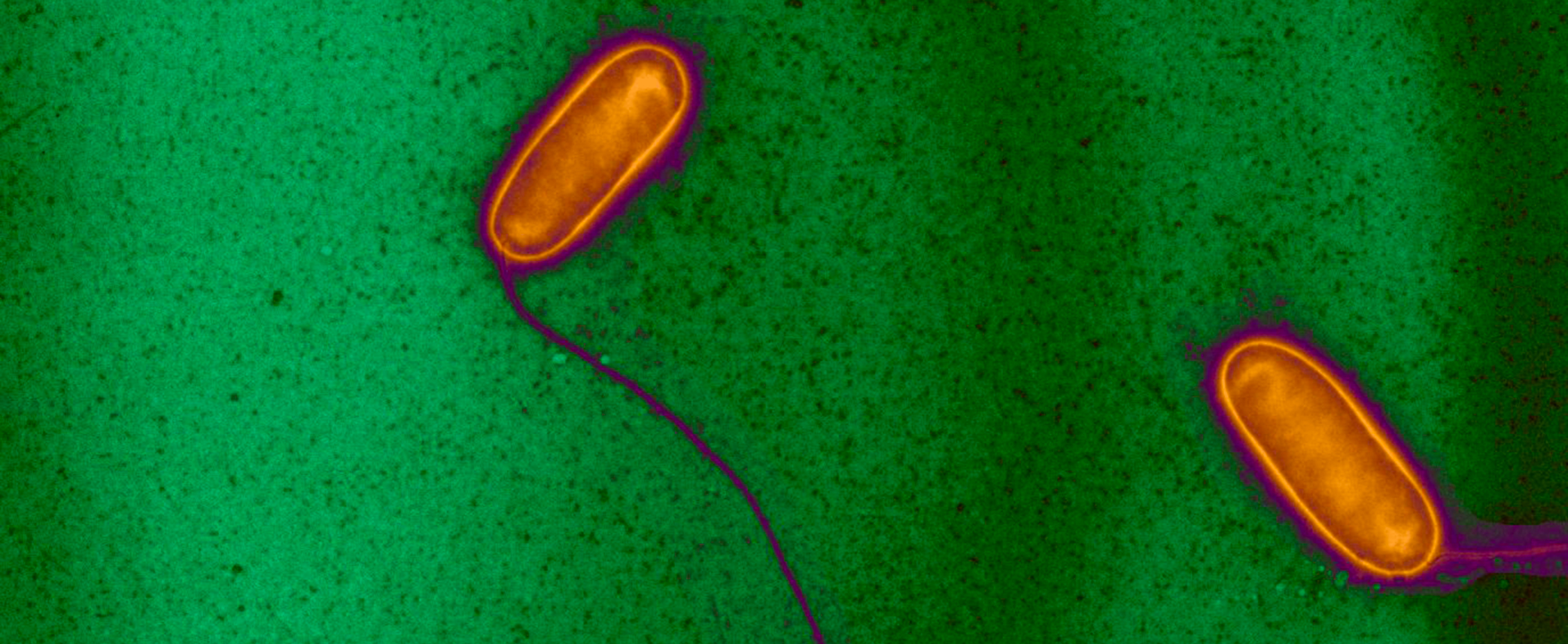 Légionellose informations et traitements Institut Pasteur — free download