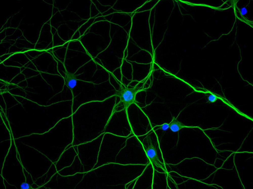 Comment la nicotine agit sur le cerveau des schizophrènes Comment la nicotine agit sur le cerveau des schizophrènes